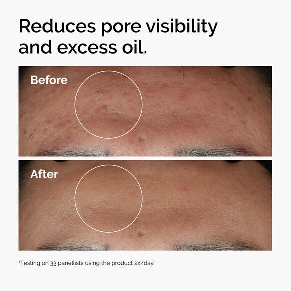 The Ordinary Niacinamide 10%